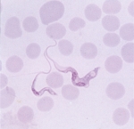 trypanosoma-evansi